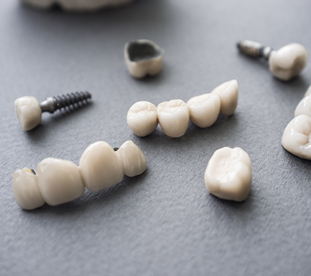 Rego Park The Difference Between Dental Implants and Mini Dental Implants