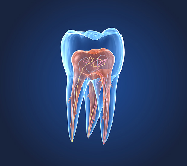 Rego Park What is an Endodontist